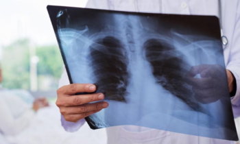 visita medica polmoni