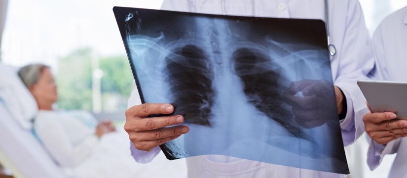 visita medica polmoni